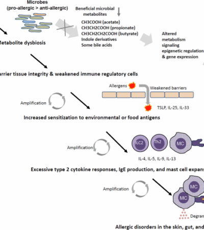 Regulation of allergies across the body by microbial metabolites