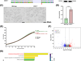 STAT1 signaling controls cholesterol metabolism in epithelial cells and RSV-induced syncytia formation