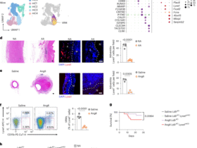 Sparcl1 mitigates abdominal aortic aneurysm through inhibiting lymphangiogenesis-mediated TLS formation