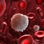 Symptoms, Causes, Diagnosis, and Treatment