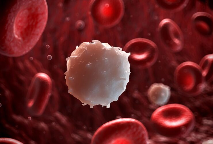 Symptoms, Causes, Diagnosis, and Treatment