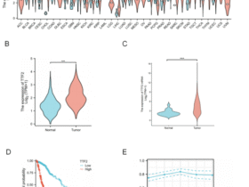 TTF2 as a potential biomarker and immunotherapy target in glioma diagnosis and prognosis