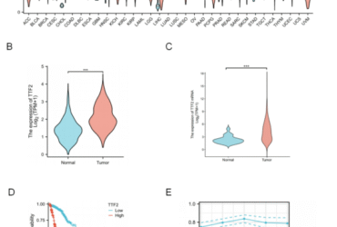 TTF2 as a potential biomarker and immunotherapy target in glioma diagnosis and prognosis