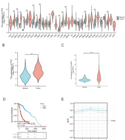 TTF2 as a potential biomarker and immunotherapy target in glioma diagnosis and prognosis