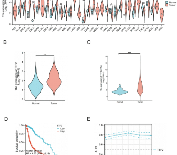 TTF2 as a potential biomarker and immunotherapy target in glioma diagnosis and prognosis