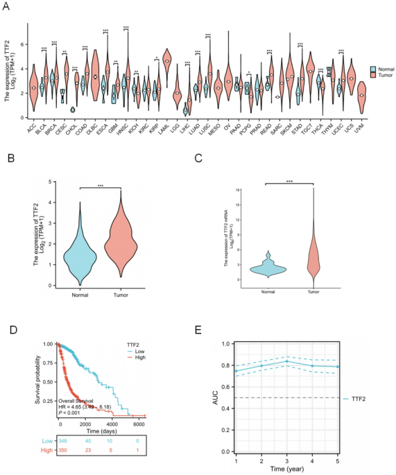 TTF2 as a potential biomarker and immunotherapy target in glioma diagnosis and prognosis