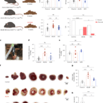 Targeting immunometabolic pathways with AZD1656 alleviates inflammation and metabolic dysfunction in type 2 diabetic cardiomyopathy