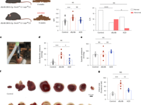 Targeting immunometabolic pathways with AZD1656 alleviates inflammation and metabolic dysfunction in type 2 diabetic cardiomyopathy
