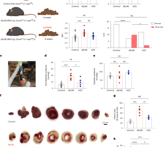Targeting immunometabolic pathways with AZD1656 alleviates inflammation and metabolic dysfunction in type 2 diabetic cardiomyopathy