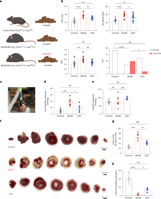 Targeting immunometabolic pathways with AZD1656 alleviates inflammation and metabolic dysfunction in type 2 diabetic cardiomyopathy