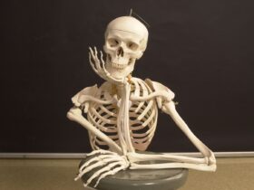 The Four Types of Bone