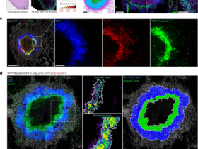 The immunometabolic topography of cellular organization and bacterial control in tuberculosis granulomas