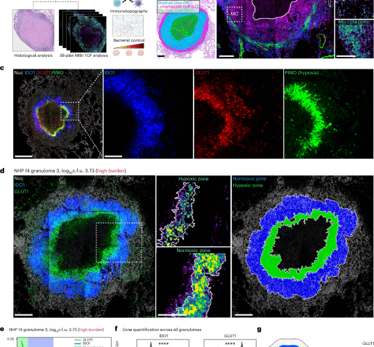 The immunometabolic topography of cellular organization and bacterial control in tuberculosis granulomas