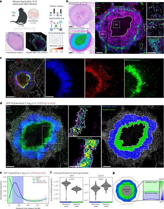 The immunometabolic topography of cellular organization and bacterial control in tuberculosis granulomas