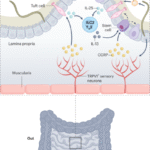 Tuft cells feel the pain