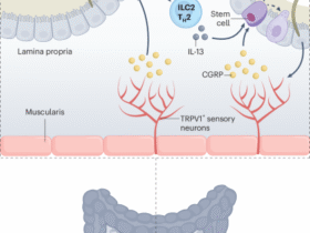 Tuft cells feel the pain