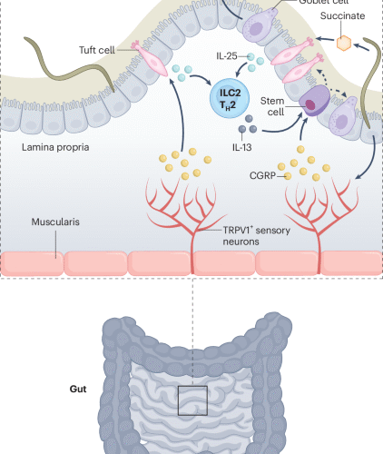 Tuft cells feel the pain