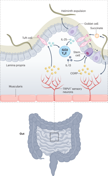 Tuft cells feel the pain