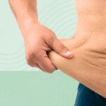 7 Things No One Tells You About Weight Loss and Excess Skin
