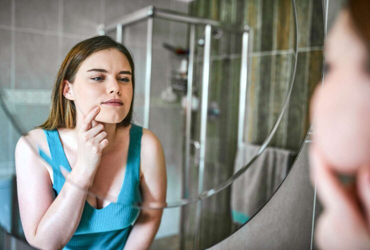 What Do HIV Mouth Sores Look Like? Here’s How to Tell