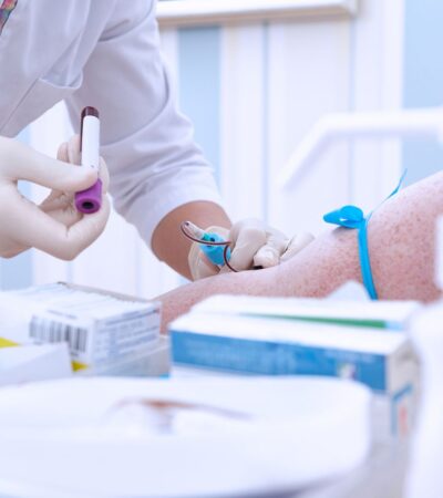 What Do High Immunoglobulin (IgE) Levels Mean for Your Health?