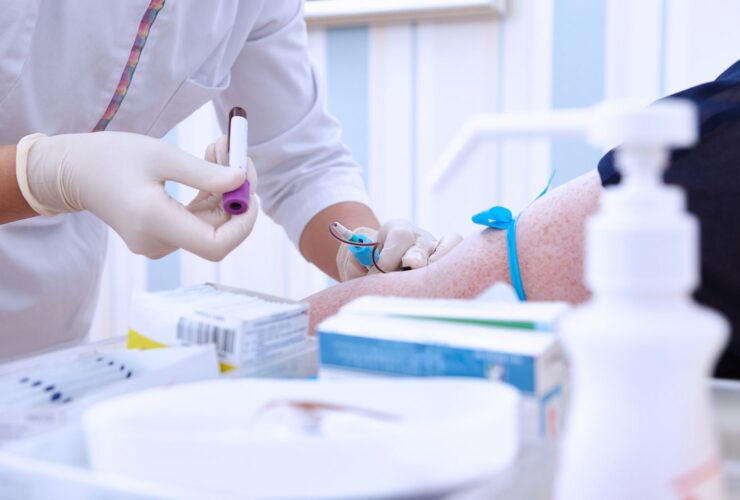 What Do High Immunoglobulin (IgE) Levels Mean for Your Health?