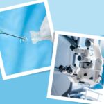 Surgery for Cataracts