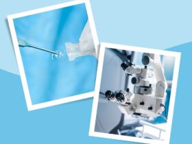 Surgery for Cataracts