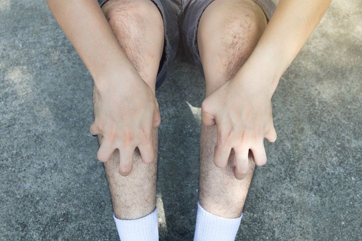 Why Your Lower Legs Might Feel Itchy and How to Stop It