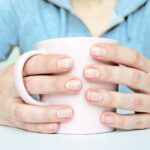 4 Reasons White Lines Appear on Your Nails, and What to Do About Them