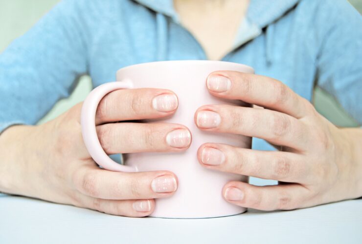 4 Reasons White Lines Appear on Your Nails, and What to Do About Them