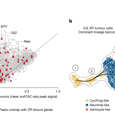 A cancer-promoting fusion protein acts during embryonic brain development