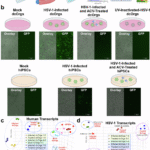 A high-throughput, quantitative platform using 2D dissociated human cerebral organoids to model neuroinflammation in Alzheimer’s disease