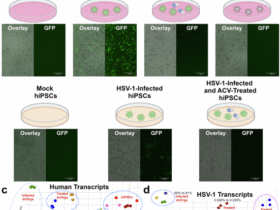 A high-throughput, quantitative platform using 2D dissociated human cerebral organoids to model neuroinflammation in Alzheimer’s disease