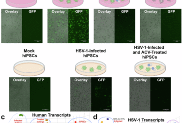 A high-throughput, quantitative platform using 2D dissociated human cerebral organoids to model neuroinflammation in Alzheimer’s disease