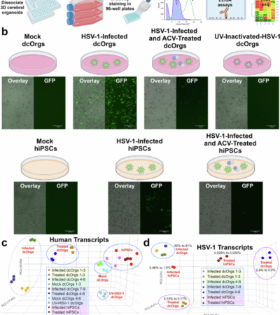 A high-throughput, quantitative platform using 2D dissociated human cerebral organoids to model neuroinflammation in Alzheimer’s disease