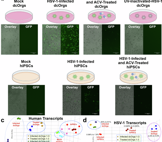 A high-throughput, quantitative platform using 2D dissociated human cerebral organoids to model neuroinflammation in Alzheimer’s disease