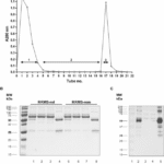A potential of serum anti-C1P IgG antibodies as biomarkers in differential diagnosis of relapsing-remitting multiple sclerosis