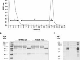 A potential of serum anti-C1P IgG antibodies as biomarkers in differential diagnosis of relapsing-remitting multiple sclerosis