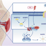ANGPTL2 inhibits macrophage pyroptosis and alleviates rheumatoid arthritis progression by regulating mitophagy via IGFBP5