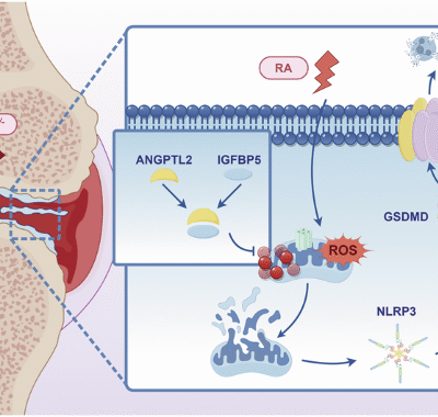 ANGPTL2 inhibits macrophage pyroptosis and alleviates rheumatoid arthritis progression by regulating mitophagy via IGFBP5