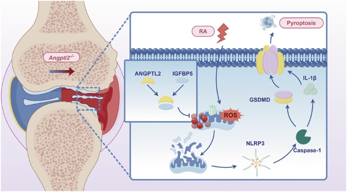 ANGPTL2 inhibits macrophage pyroptosis and alleviates rheumatoid arthritis progression by regulating mitophagy via IGFBP5