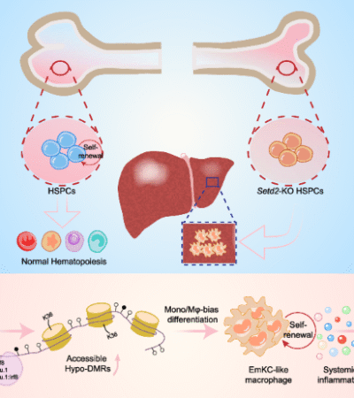 Aberrant Kupffer-like differentiation of hematopoietic stem cell is critical for the MDS pathogenesis in Setd2-deficient mice