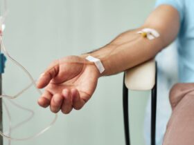 What Does Treatment for ANCA-Associated Vasculitis (AAV) Look Like Today?