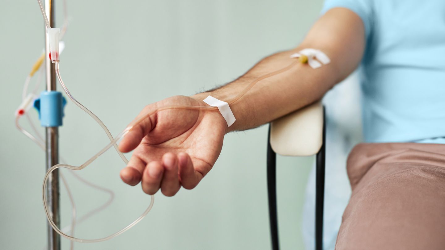 What Does Treatment for ANCA-Associated Vasculitis (AAV) Look Like Today?