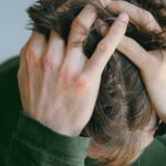 Atopic Dermatitis Treatment Burnout Is a Real Thing