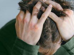 Atopic Dermatitis Treatment Burnout Is a Real Thing