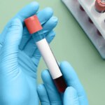 Blood Test May Predict Dementia in Women 25 Years Before Symptoms Appear