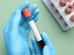 Blood Test May Predict Dementia in Women 25 Years Before Symptoms Appear