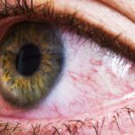 Can Bloodshot Eyes Be Serious? When to Seek Help